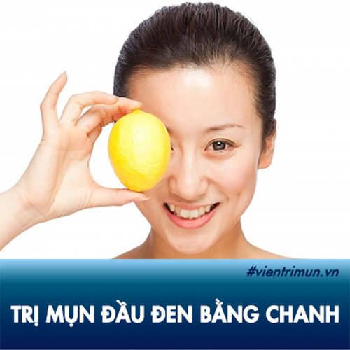 11 cách trị mụn đầu đen bằng chanh giúp bạn “Say goodbye” những đốm đen đáng ghét