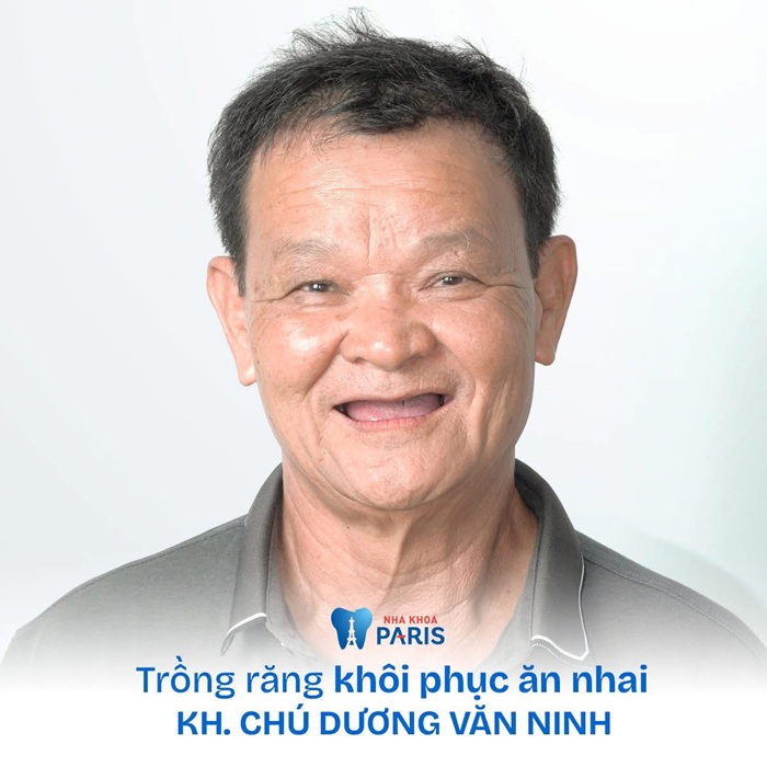 Khách hàng trồng răng tại Paris hài lòng